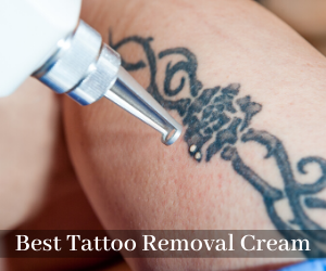 Best Tattoo Removal Cream