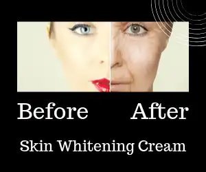 skin whitening cream before and after